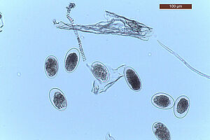 Photo microscopique d’œufs de parasites intestinaux qui ont été isolés dans des bouses de bovins. 